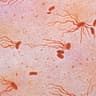 Avatar of player Salmonella typhi
